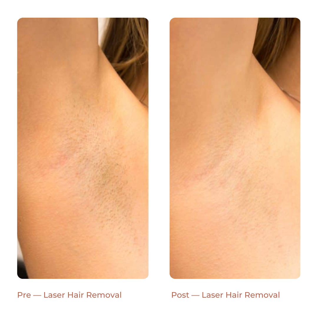 Landing Page Before + After