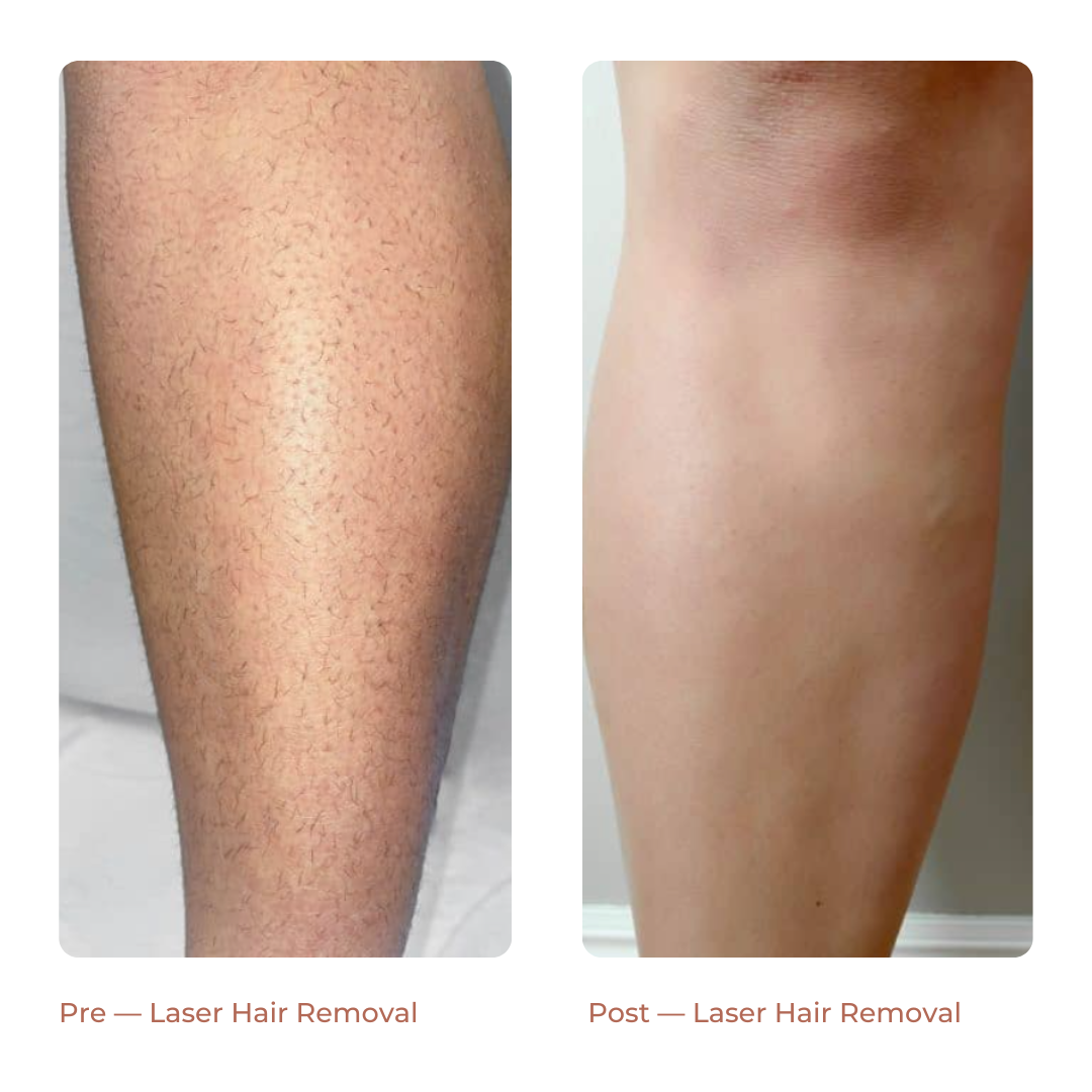 Landing Page Before + After 