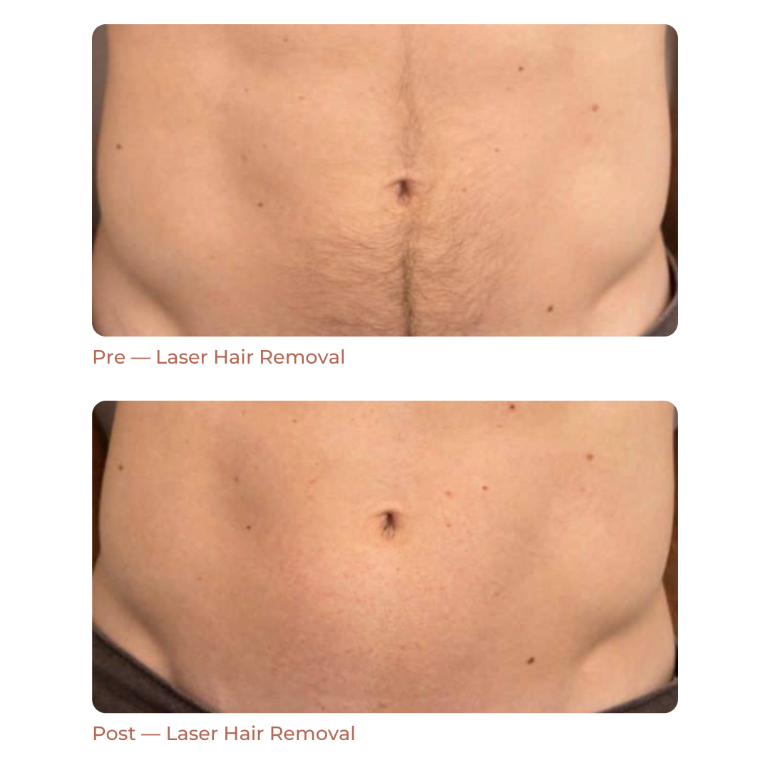 Landing Page Before + After