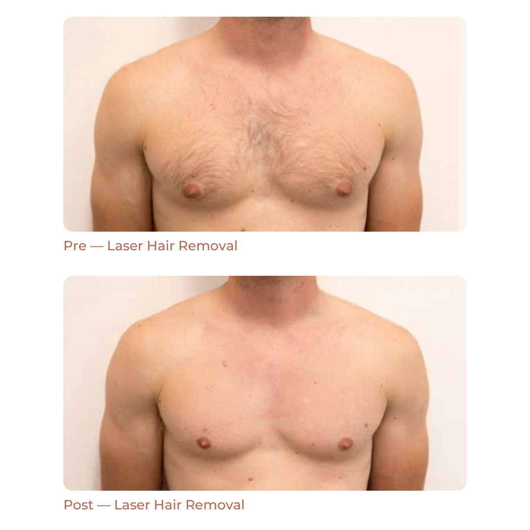 Landing Page Before + After 