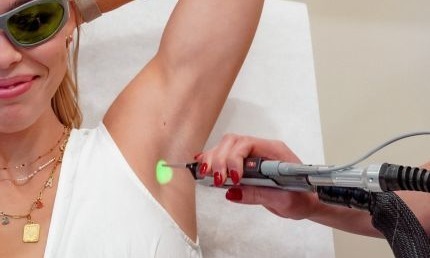 Laser Hair Removal