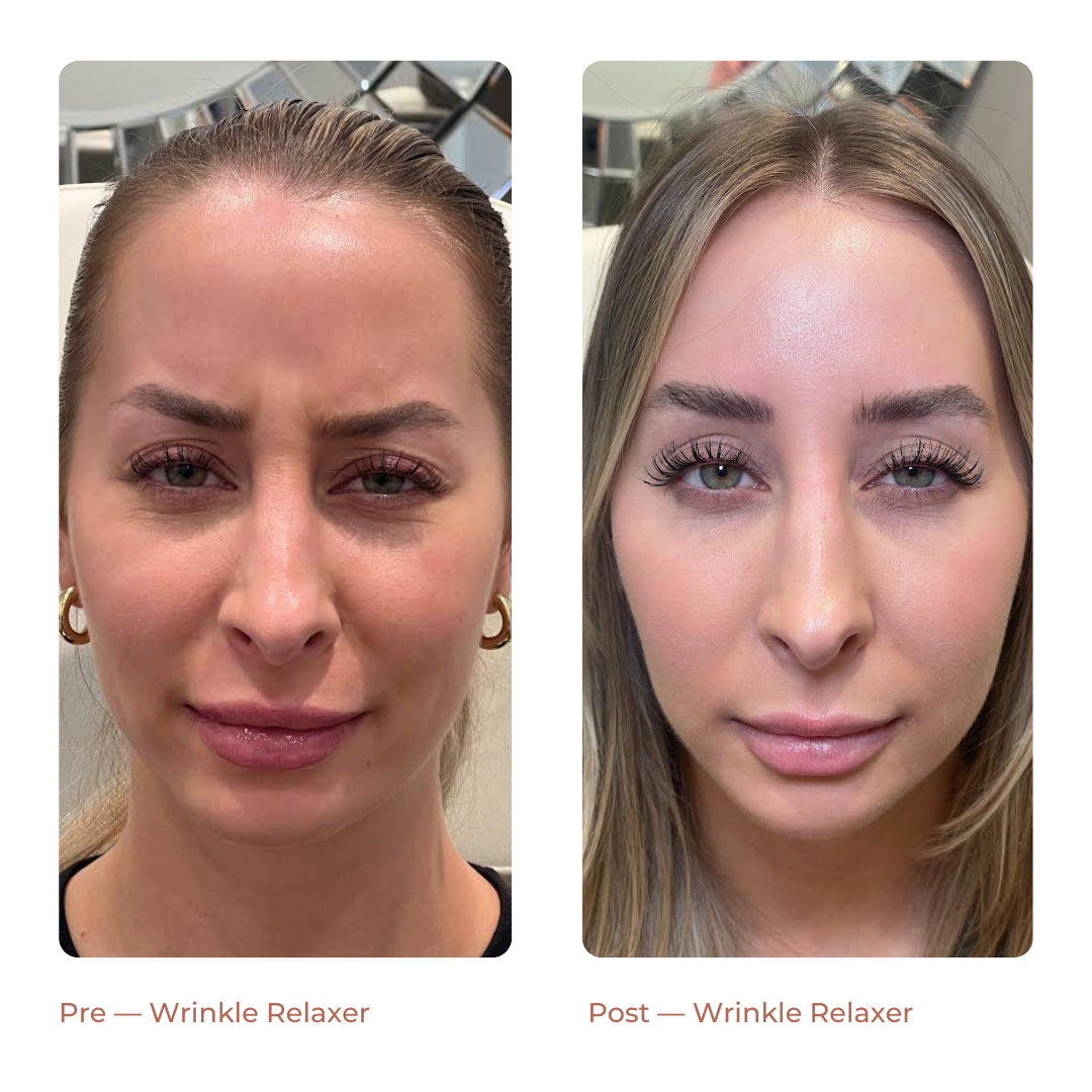 Copy of Landing Page — Before + After (2)