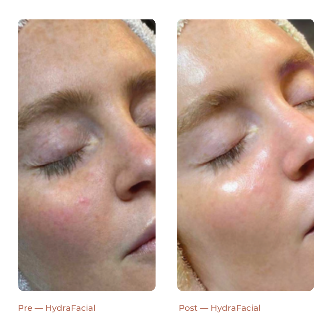 Copy of Landing Page — Before + After (3)