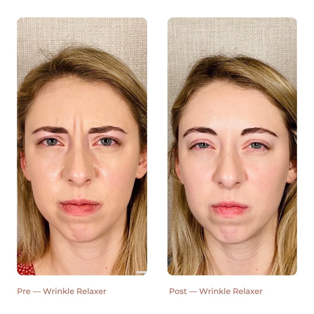 Copy of Landing Page — Before + After (6)