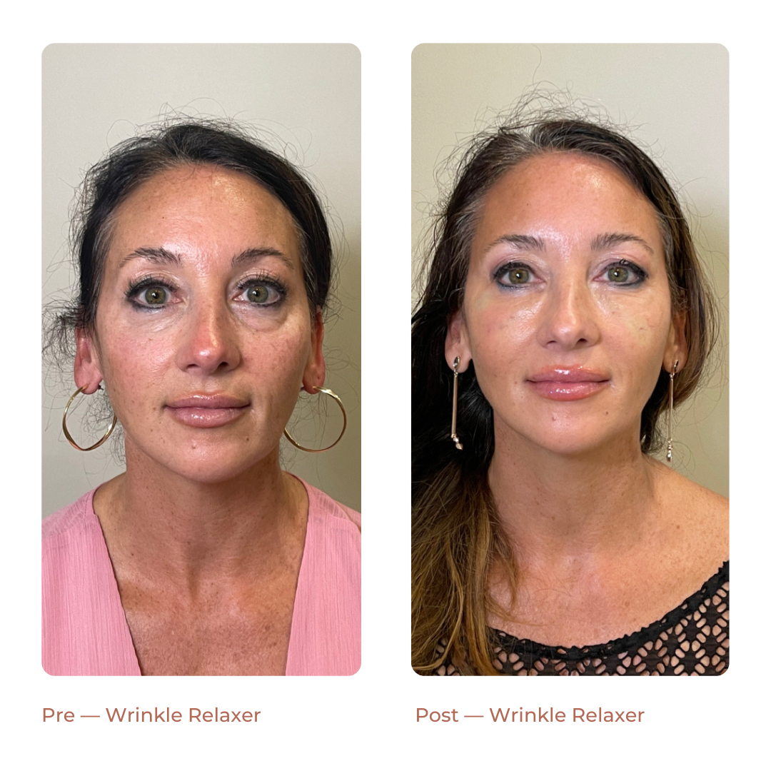 Copy of Landing Page — Before + After (7)