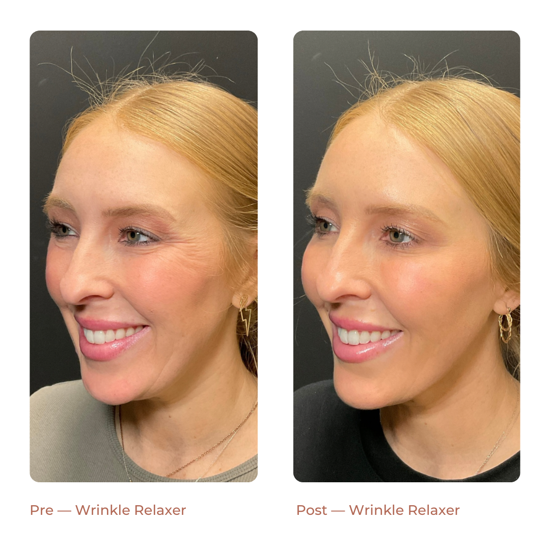 Copy of Landing Page — Before + After (8)