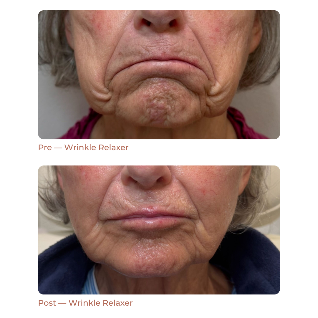 Copy of Landing Page — Before + After (9)