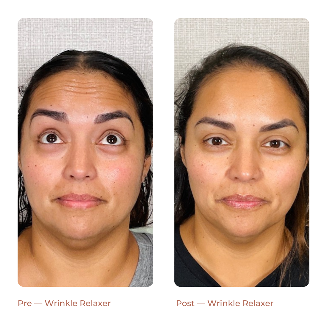 Copy of Landing Page — Before + After