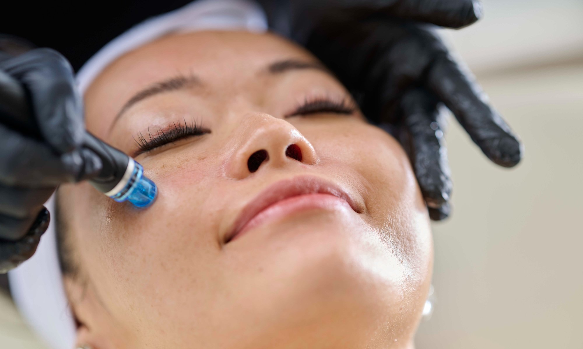 Hyrdafacial Platinum