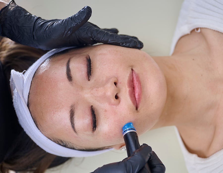 HydraFacial