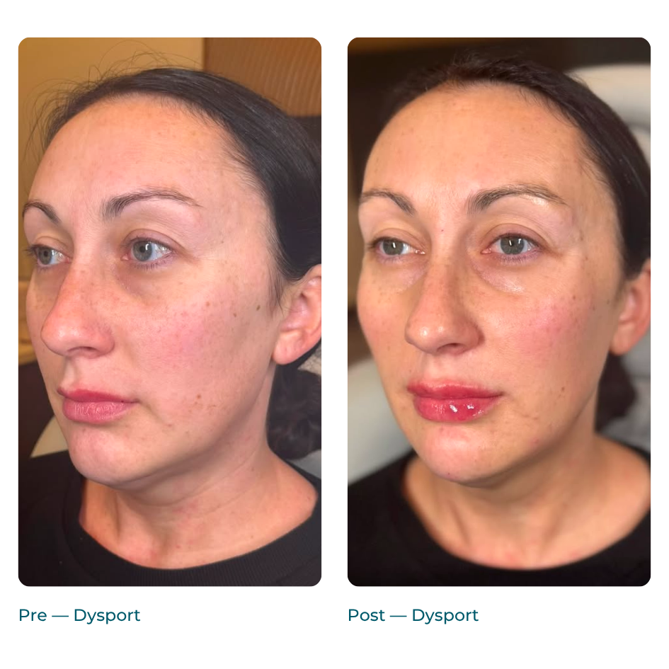 Landing Page — Before + After