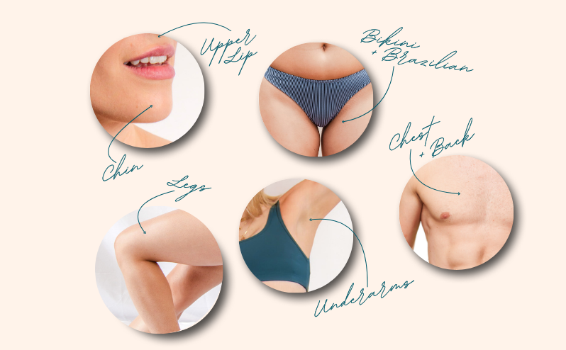 Treatment areas for laser hair removal: upper lip, chin, legs, underarms, bikini, chest, and back